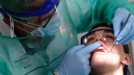 Ofrecen limpieza dental gratis en Carabobo (+Detalles)