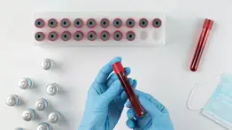 El descubrimiento sobre las plaquetas que puede revolucionar la lucha contra el cáncer: hallazgo de la Universidad de Oxford