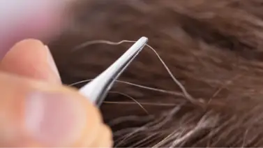¿Arrancar las canas? La Dra. Pascali explica las consecuencias de este procedimiento en tu cabello ¿Arrancar las canas? La Dra. Pascali explica las consecuencias de este procedimiento en tu cabello
