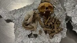 2001online - USA - Restos Humanos