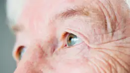 ¿Operado de cataratas? Estos son los problemas que podrías enfrentar después de la cirugía