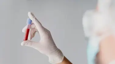 Dile adiós a la anemia con este jugo rico en hierro y vitaminas a base de fresa: sigue estos pasos para prepararlo  Dile adiós a la anemia con este jugo rico en hierro y vitaminas a base de fresa: sigue estos pasos para prepararlo