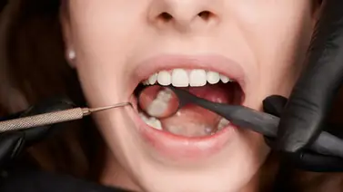Batalla contra la placa bacteriana: hábitos para mantener una boca sana Batalla contra la placa bacteriana: hábitos para mantener una boca sana