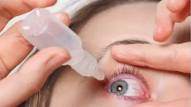 Síndrome del ojo seco: causas de una dolencia común y claves diarias para su control Síndrome del ojo seco: causas de una dolencia común y claves diarias para su control