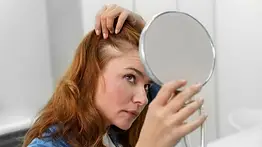 Aceite de romero: ¿Es realmente beneficioso para la caída del cabello y quiénes pueden usarlo?