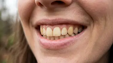Tonos de labiales ideales para disimular los dientes amarillos: teoría del color aplicada al maquillaje Tonos de labiales ideales para disimular los dientes amarillos: teoría del color aplicada al maquillaje