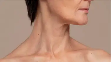 Claves indispensables para proteger la delicada piel del cuello: obtén firmeza y juventud Claves indispensables para proteger la delicada piel del cuello: obtén firmeza y juventud