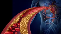 Esta es la semilla que ayuda a controlar la hipertensión arterial