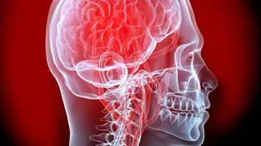 Conoce cuál es el grano que evita la formación de coágulos en el cerebro Conoce cuál es el grano que evita la formación de coágulos en el cerebro