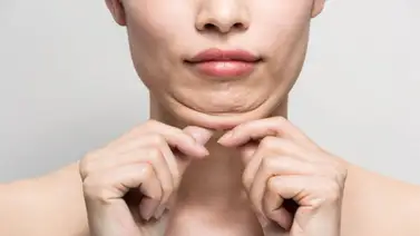 ¡Adiós papada! Este es el mejor método para eliminarla sin cirugía  ¡Adiós papada! Este es el mejor método para eliminarla sin cirugía