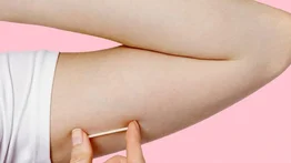 Realizarán colocación de implantes subdérmicos gratis en Valencia