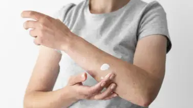 Anuncian jornada dermatológica gratuita en Carabobo Anuncian jornada dermatológica gratuita en Carabobo