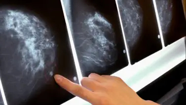 Chile solicita extradición de médico venezolano por falsos diagnósitcos de cáncer  Chile solicita extradición de médico venezolano por falsos diagnósitcos de cáncer