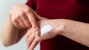 Crema creada para pacientes oncológicos: menos dolor y más calidad de vida Crema creada para pacientes oncológicos: menos dolor y más calidad de vida