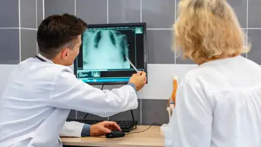 Un hallazgo vital: una proteína que en las metástasis óseas evade la inmunoterapia Un hallazgo vital: una proteína que en las metástasis óseas evade la inmunoterapia