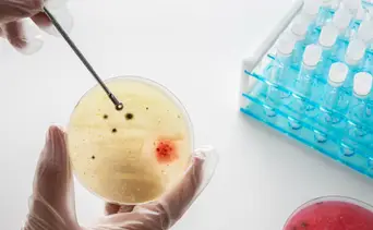 Freno a las bacterias resistentes: descubren cómo convertir el vinagre en un súper antígeno