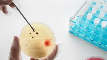 Freno a las bacterias resistentes: descubren cómo convertir el vinagre en un súper antígeno Freno a las bacterias resistentes: descubren cómo convertir el vinagre en un súper antígeno