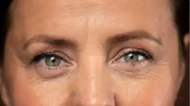 Despídete de las líneas de expresión: cosmetóloga revela el ingrediente milagroso para lucir un rostro joven Despídete de las líneas de expresión: cosmetóloga revela el ingrediente milagroso para lucir un rostro joven