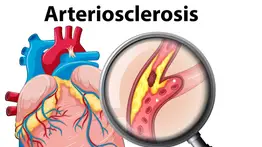 Expertos de Harvard alertan sobre los peligros de saltarse el desayuno: así afecta a tus arterias