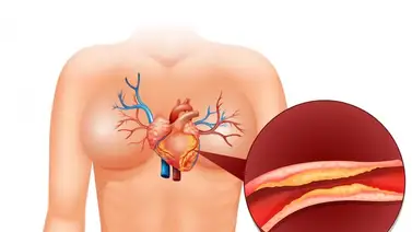 Limpia las arterias con tres ingredientes económicos rico en antioxidantes que siempre tienes en casa: así debes preparar y consumir el jugo Limpia las arterias con tres ingredientes económicos rico en antioxidantes que siempre tienes en casa: así debes preparar y consumir el jugo