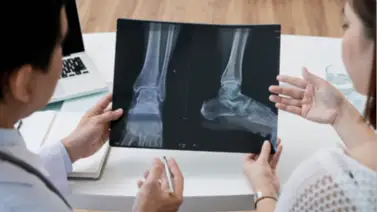 Fractura por osteoporosis: la internista Andrea Odreman da las claves para prevenir y aliviar el dolor Fractura por osteoporosis: la internista Andrea Odreman da las claves para prevenir y aliviar el dolor