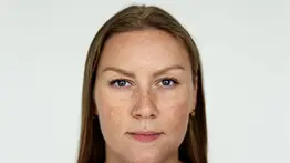 Elimina las manchas del rostro: necesitas solo estos dos ingredientes muy populares y a bajo costo que siempre tienes en casa