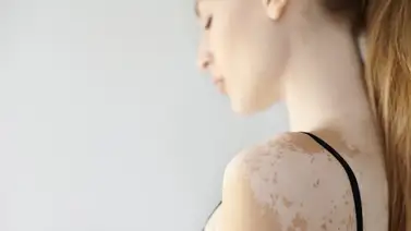 Elimina las manchas de la piel con esta milagrosa mascarilla: solo necesitas tres ingredientes económicos  Elimina las manchas de la piel con esta milagrosa mascarilla: solo necesitas tres ingredientes económicos