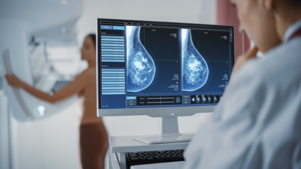 Nuevas perspectivas en salud femenina: la urgencia de ajustar la edad y frecuencia de las mamografías