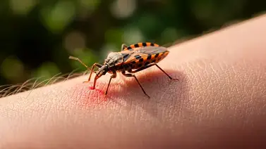 Alertan sobre el incremento de casos de mal de Chagas por consumo de jugos artesanales Alertan sobre el incremento de casos de mal de Chagas por consumo de jugos artesanales