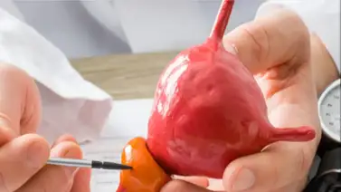 Mes Azul | Dos de cada 10 hombres en Venezuela sufren de cáncer de próstata Mes Azul | Dos de cada 10 hombres en Venezuela sufren de cáncer de próstata