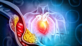 La infusión para regular la presión arterial, el colesterol y los triglicéridos