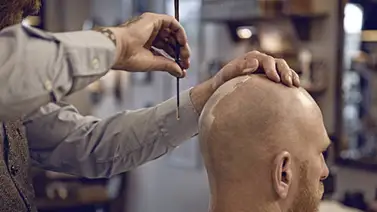 Cuidar la calva tiene su precio: conozca los tratamientos y precios Cuidar la calva tiene su precio: conozca los tratamientos y precios