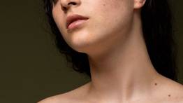 Desmancha la piel con esta fórmula natural a base de aloe vera: aprende a utilizarla para aprovechar su máximo efecto