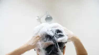 Conoce cuál es la hierba aromática que combate la caspa y la caída del cabello: así debes aplicarla Conoce cuál es la hierba aromática que combate la caspa y la caída del cabello: así debes aplicarla