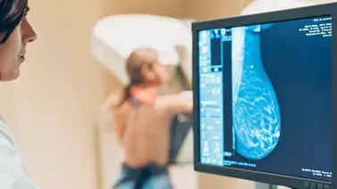 mamografías mamografías