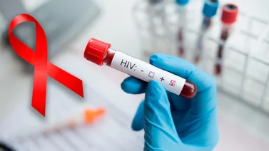 Realizan estudios para diagnóstico rápido de VIH en Bolívar