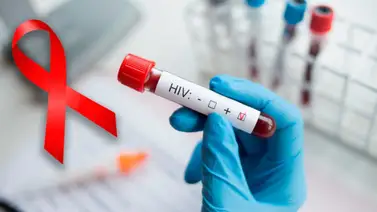 Realizan estudios para diagnóstico rápido de VIH en Bolívar Realizan estudios para diagnóstico rápido de VIH en Bolívar