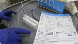 EEUU | Analizan muestras de leche en todo el país por infección viral 