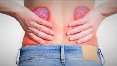 Tres trucos para limpiar los riñones fácil y rápido Tres trucos para limpiar los riñones fácil y rápido