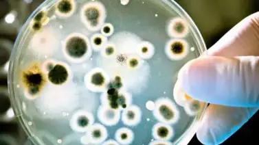 Ataca correctamente las bacterias y microbios conociendo sus diferencias Ataca correctamente las bacterias y microbios conociendo sus diferencias