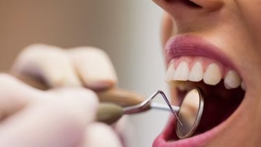 Mujer practicaba procedimientos odontológicos en la cocina de su casa