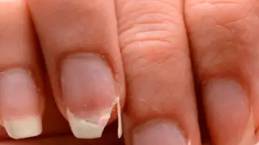 ¿Por qué tengo las uñas frágiles y qué puedo hacer para recuperarlas? ¿Por qué tengo las uñas frágiles y qué puedo hacer para recuperarlas?