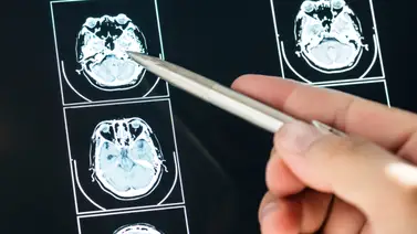 Aprenden a jugar con la mente: implante cerebral cambiará la vida de las personas con parálisis Aprenden a jugar con la mente: implante cerebral cambiará la vida de las personas con parálisis