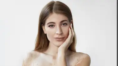 Elimina las manchas en la piel con esta mascarilla natural: solo debes mezclar tres ingredientes que siempre tienes en casa Elimina las manchas en la piel con esta mascarilla natural: solo debes mezclar tres ingredientes que siempre tienes en casa