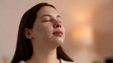 Esta es la mascarilla natural a base de aloe vera que desmancha la piel fácil y rápido: así debes aplicarla Esta es la mascarilla natural a base de aloe vera que desmancha la piel fácil y rápido: así debes aplicarla